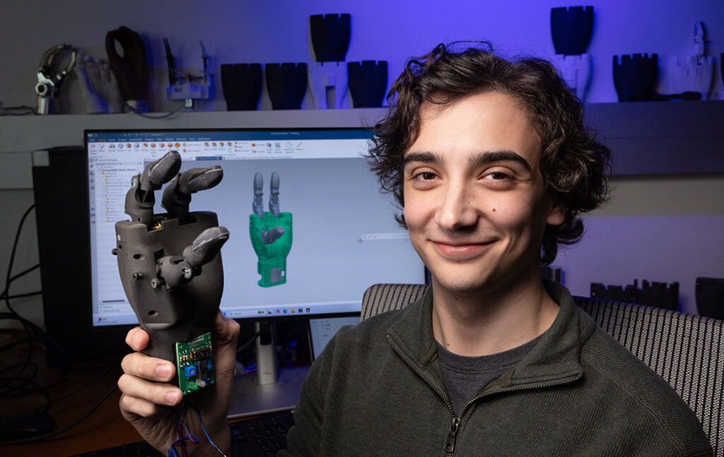 An affordable prosthetic hand for global change